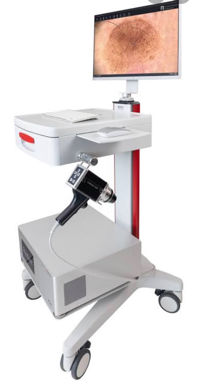 Equipamento de mapeamento digital de pintas